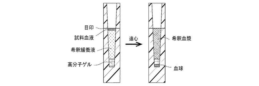 血漿分離ゲル化剤入り血液希釈保存容器による希釈血漿分離法