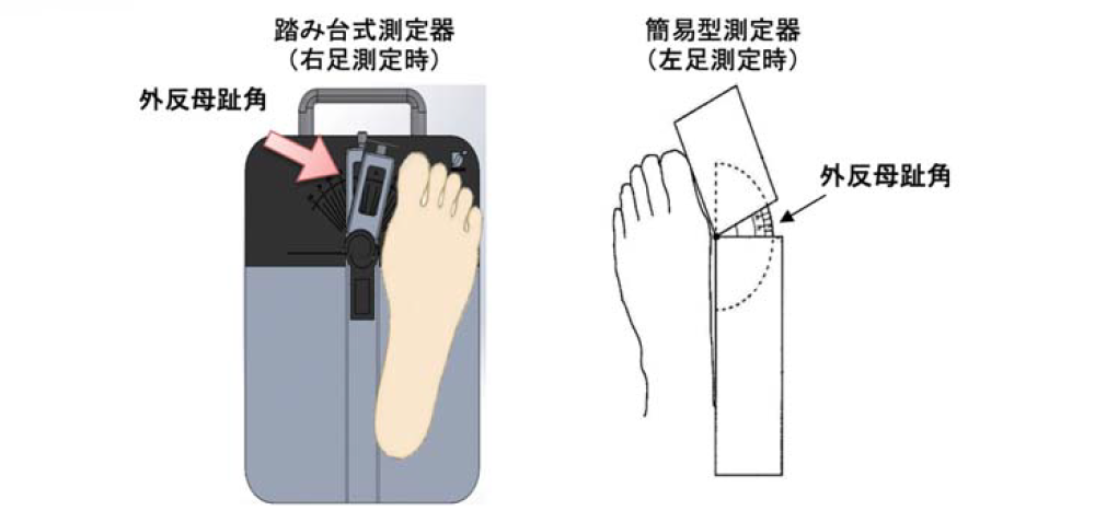 外反母趾角の測定具