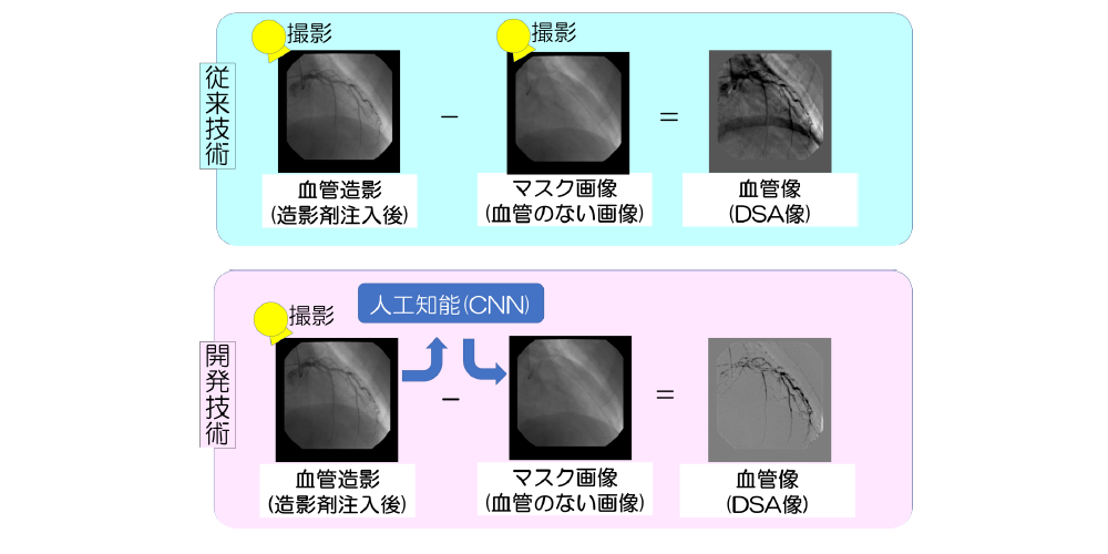 生体画像処理装置、出力画像製造方法、学習結果製造方法、及びプログラム