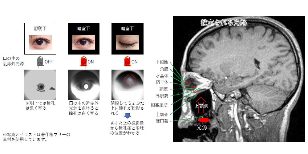 眼球状態観察方法および眼球状態観察システム