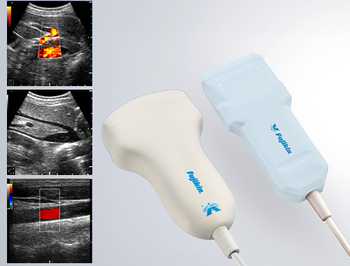 Ultrasound Diagnostic Equipment(MUS-P0303)