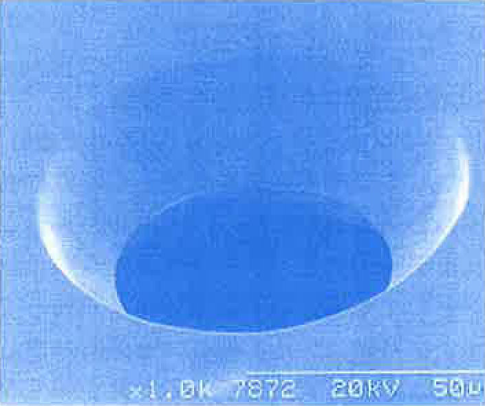 Diagram 26. SEM photograph of the orifice shape (1000x magnification)