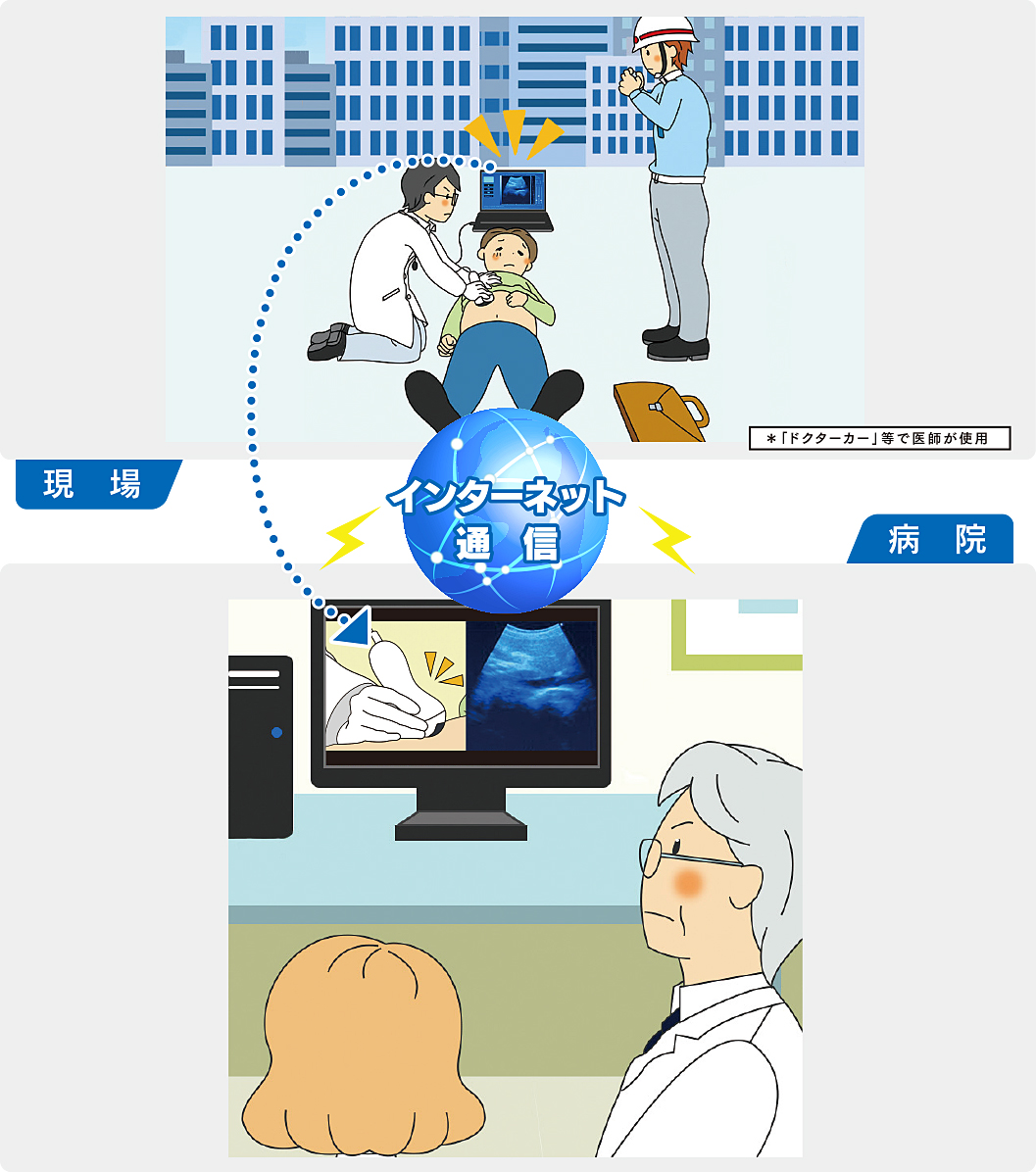 インターネット通信により、現場での超音波画像とプローブ操作部位の映像を病院へ送ることができます。