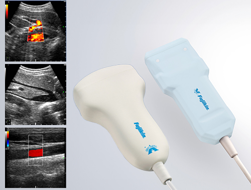MUS-P0303シリーズ超音波診断装置