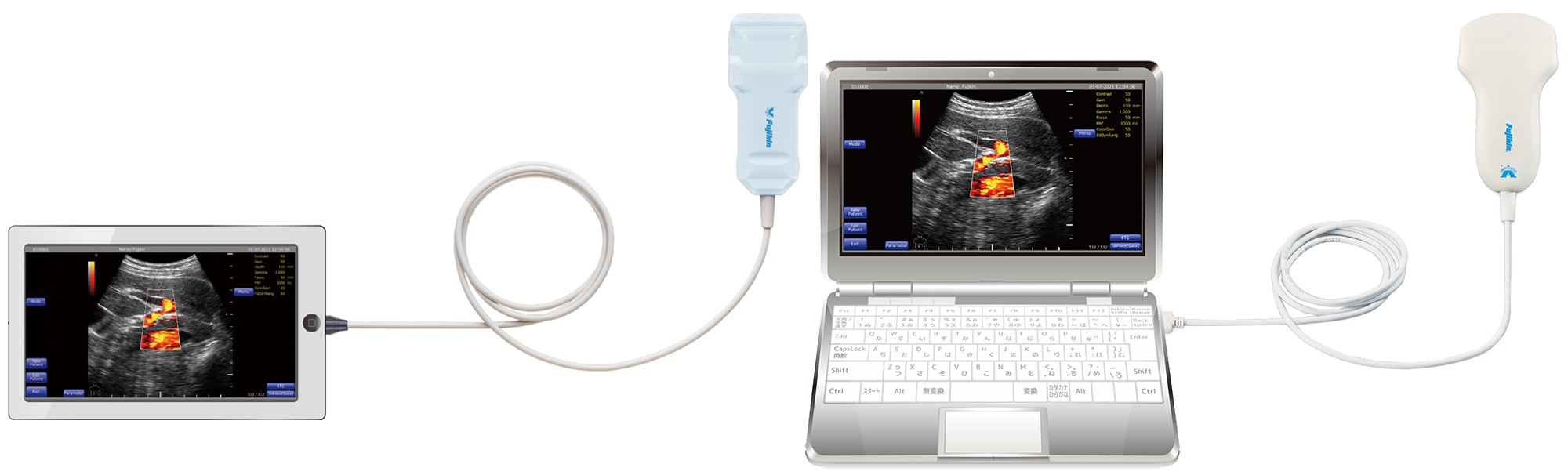 超音波診断装置 ポータブル＆カラー｜医療機器関連｜ライフサイエンス