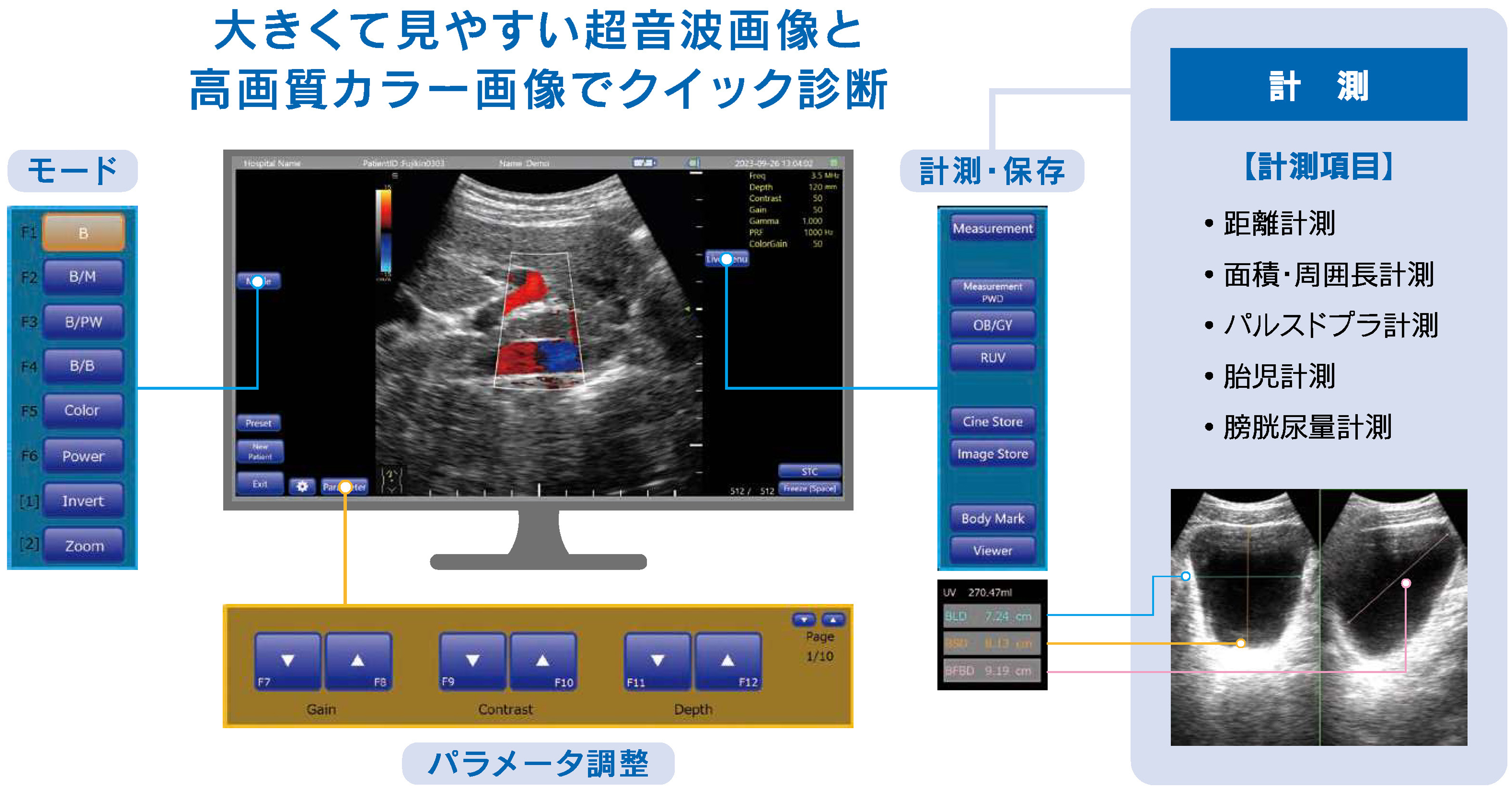 MUS-P0303　計測機能