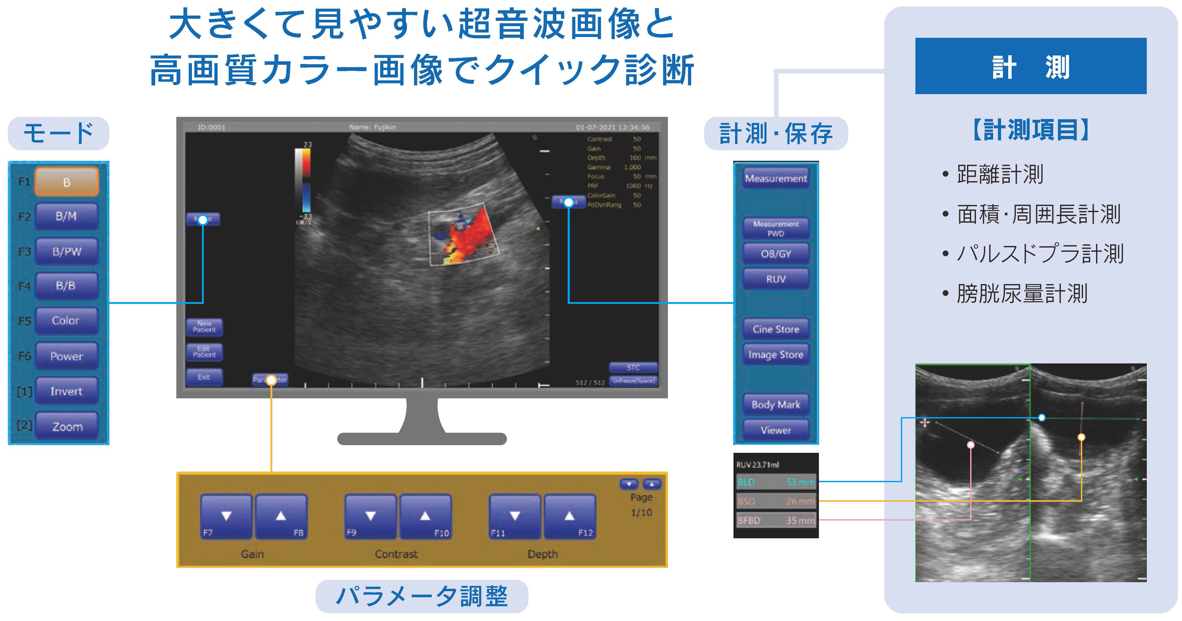 MUS-P0303　計測機能