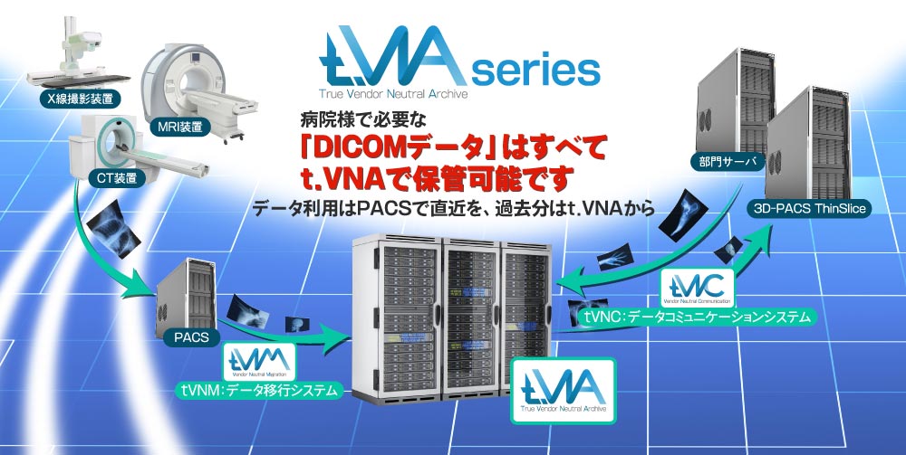 PACS間データ移行は不要